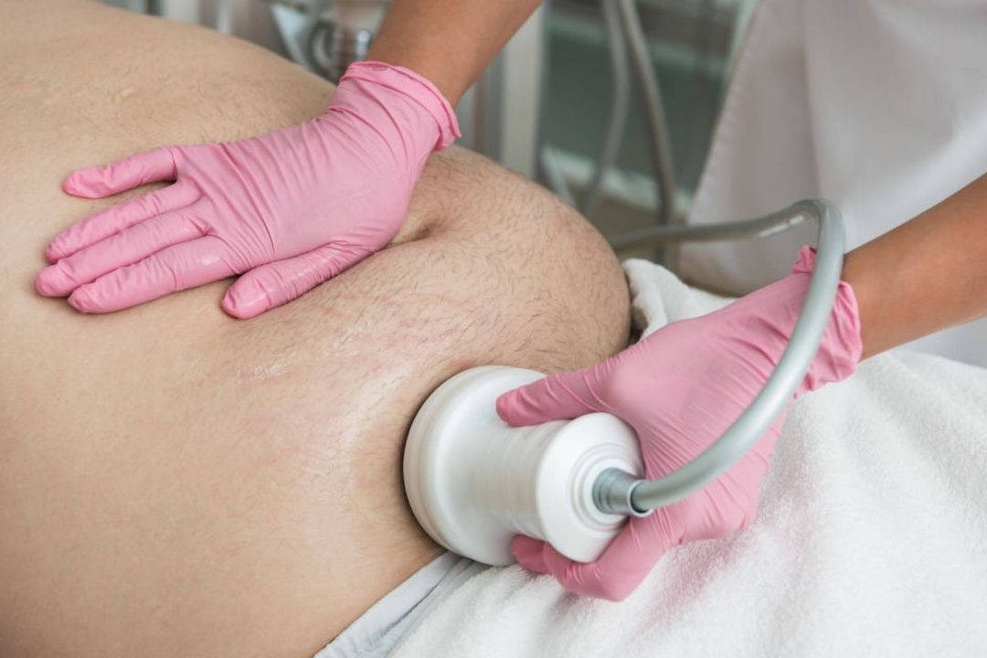 Tratamento de Lipocavitação em Uberlândia